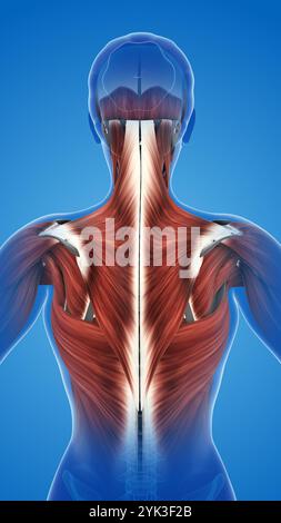 Schmerzen und Schädigungen der Muskulatur Trapezius Stockfoto