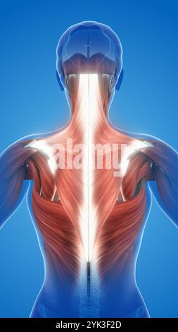 Schmerzen und Schädigungen der Muskulatur Trapezius Stockfoto
