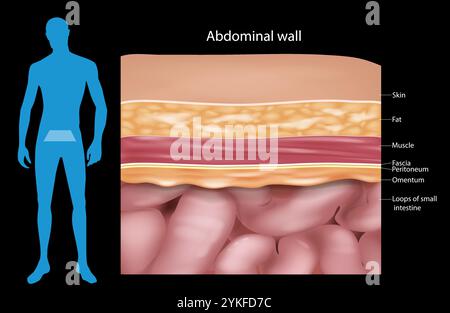 Bauchwandlagen, Muskeln und Faszien. Querschnittsanatomie Bauchwand. Stock Vektor