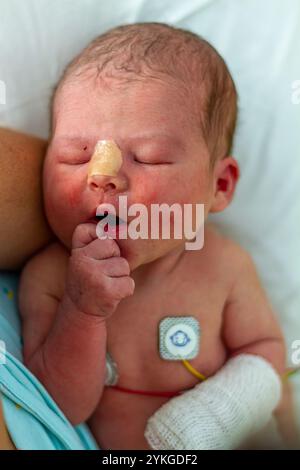 Neugeborenes im Krankenhaus mit Überwachungssensoren und Schutzverband Stockfoto