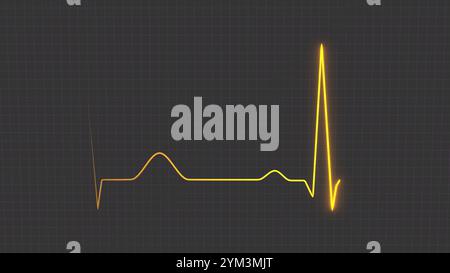 Normales Herzrhythmus-EKG-Elektrokardiogramm eines Gesunden, Herzuntersuchungsmethode Stockfoto