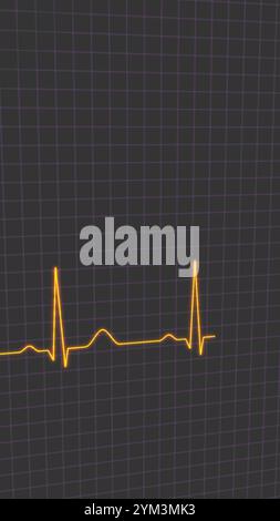 Normales Herzrhythmus-EKG-Elektrokardiogramm eines Gesunden, Herzuntersuchungsmethode Stockfoto