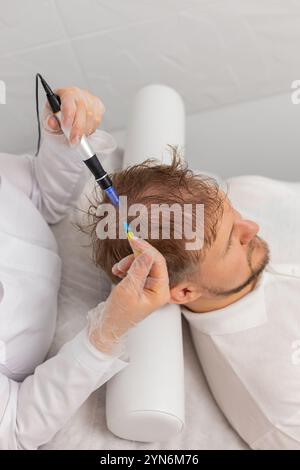 Alopezie. Mann Haarausfall verbessern Wachstum Behandlung Regeneration Dermapen Mikroneedling Vitamin Exosomen Plasma Spritzenspritzen Injektionen. Trichologe Kosmetologe Arzt Kopf-Verfahren fraktionelle Mesotherapie Stockfoto