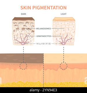 Hauttonpigmentierungsdiagramm Stock Vektor