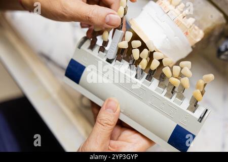 Eine Nahaufnahme einer Zahnfarbführung mit verschiedenen Zahnfarben, die für die passende Zahnprothetik in einem Dentallabor verwendet werden Stockfoto