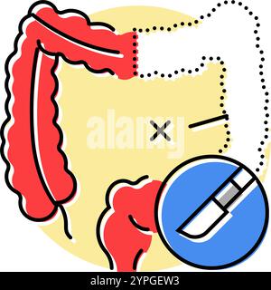 Darmresektion Chirurgie Arzt Farbe Symbol Vektor Illustration Stock Vektor