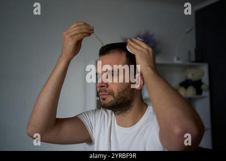 Ein 30-jähriger Mann wendet ein Produkt für Haarwuchs an, Behandlung von Kahlheit Stockfoto