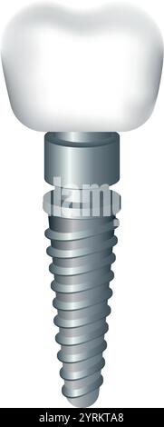 Vektorabbildung eines auf transparentem Hintergrund isolierten Zahnimplantats. Stock Vektor