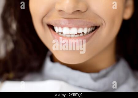 Nahaufnahme Der Nicht Erkennbaren Schwarzen Lady, Die Mit Ihren Perfekten Weißen Zähnen Weithin Lächelt Stockfoto