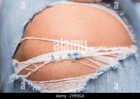 Nahaufnahme einer zerrissenen Jeans mit Haut am Knie Stockfoto