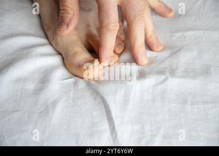 Nahaufnahme des Zehens einer Person mit beschädigtem Zehennagel, der überprüft wird. Das Bild zeigt die Pflege oder Beurteilung eines verletzten Nagels Stockfoto