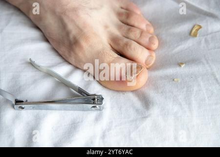 Ein beschädigter Zehennagel, der mit Nagelschneider auf einer weißen Oberfläche geschnitten wird. In Innenräumen genommen, zeigt es persönliche Pflege und Hygiene, um Nagelgesundheit Probleme zu behandeln Stockfoto