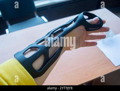 Handschienen-Korsett-Prothese auf 3D-Drucker aus geschmolzenem schwarzem Kunststoffpulver auf der Hand gedruckt. Kunststoffüberlagerung für Fixierer für medizinische Orthesen auf 3D-Drucker erstellt. Neue moderne medizinische 3D-Drucktechnologie, Stockfoto