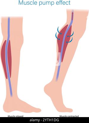 Skelettmuskelpumpeneffekt. Zur Darstellung des Muskelpumpeneffekts auf Venenrücklauf und Muskelblut. Stock Vektor