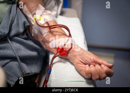 CARDIFF, WALES - 20. AUGUST: Eine Nahaufnahme eines Dialysegeräts in einem NHS-Krankenhaus am 20. August 2024 in Cardiff, Wales. Stockfoto