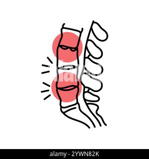 Farblinie für Spondylitis ankylosans. Erkrankungen der Wirbelsäule. Vertebrologie. Vektorisoliertes Element. Bearbeitbare Kontur. Stock Vektor