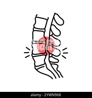 Symbol für die Farblinie der Lumbalstenose. Erkrankungen der Wirbelsäule. Vertebrologie. Vektorisoliertes Element. Bearbeitbare Kontur. Stock Vektor