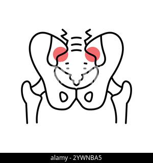 Sacroiliitis-Farblinien-Symbol. Erkrankungen der Wirbelsäule. Vertebrologie. Vektorisoliertes Element. Bearbeitbare Kontur. Stock Vektor