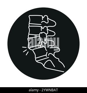 Symbol für die Farblinie der Spondylolisthesis. Erkrankungen der Wirbelsäule. Vertebrologie. Vektorisoliertes Element. Bearbeitbare Kontur. Stock Vektor