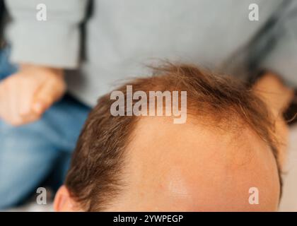 Spärliche Haare auf dem Kopf eines Mannes, der Prozess der Kahlheit. Hochwertige Fotos Stockfoto