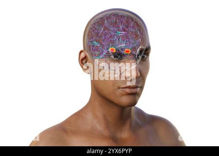 Computerdarstellung des menschlichen Gehirns mit einer hervorgehobenen Amygdala. Die Amygdala ist verantwortlich für Emotionsverarbeitung, Angstreaktion und Gedächtnisbildung. Stockfoto