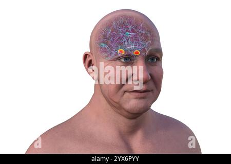 Computerdarstellung des menschlichen Gehirns mit einer hervorgehobenen Amygdala. Die Amygdala ist verantwortlich für Emotionsverarbeitung, Angstreaktion und Gedächtnisbildung. Stockfoto