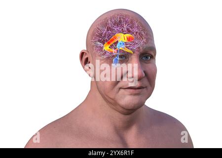 Computerdarstellung der lateralen Hirnventrikel, der größten gepaarten Hohlräume im Gehirn, die für die Produktion und Zirkulation von Liquor verantwortlich sind. Stockfoto