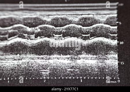 Kardialer Ultraschall, Echokardiographie, medizinische Bildgebung mit Ultraschall zur Untersuchung des Herzens, mit Standard- oder doppler-Ultraschall, ein Echokardiographie Stockfoto