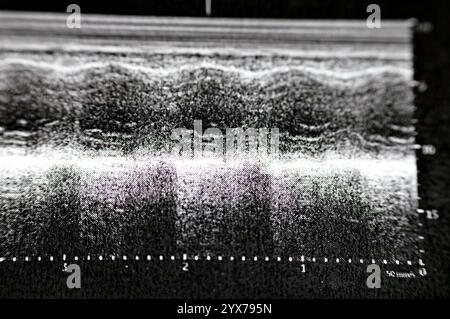 Kardialer Ultraschall, Echokardiographie, medizinische Bildgebung mit Ultraschall zur Untersuchung des Herzens, mit Standard- oder doppler-Ultraschall, ein Echokardiographie Stockfoto