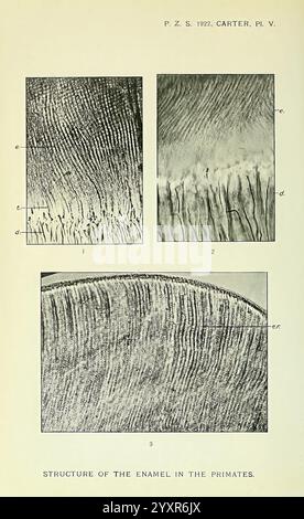 Die Darstellung zeigt eine detaillierte Untersuchung der Schmelzstruktur von Primaten. Es besteht aus vier beschrifteten Abschnitten, die verschiedene Vergrößerungen und Perspektiven des Emails zeigen. Der obere linke Abschnitt zeigt eine Nahansicht der Mikrostruktur des Emails und zeigt komplizierte Streifen und Muster. Der obere rechte Abschnitt hebt einen anderen Winkel der Emailoberfläche hervor, wodurch die Textur und die Schichtstruktur betont werden. Der untere Abschnitt bietet einen umfassenderen Überblick über die Emaille und zeigt die allgemeine Kurve Stockfoto