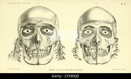 Bericht über die zoologischen Sammlungen im Indopazifischen Ozean während der Reise von H.M.S. 'Alert' 1881-2. London, 1884. Alert's Loop, 1856-1895, Australien, Inseln des Indischen Ozeans, Melanesien, Wissenschaftliche Expeditionen, Zoologie, Schädel, Schädel von Torres Straits Islanders, Torres Straits, Human Crania, Pierre Jacques Smit, 8, Pin, Seitenrechte, IG, Daily Sci Art, Homo sapiens., die Abbildung zeigt zwei detaillierte anatomische Darstellungen eines menschlichen Schädels mit der Bezeichnung A und B, die die Frontalansicht darstellen. Jeder Schädel wird aufwändig gerendert, wobei besondere Merkmale wie der Kubikkopf hervorgehoben werden Stockfoto