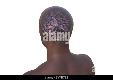 Computerdarstellung des menschlichen Gehirns mit einer hervorgehobenen Amygdala. Die Amygdala ist verantwortlich für Emotionsverarbeitung, Angstreaktion und Gedächtnisbildung. Stockfoto