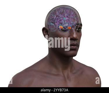 Computerdarstellung des menschlichen Gehirns mit einer hervorgehobenen Amygdala. Die Amygdala ist verantwortlich für Emotionsverarbeitung, Angstreaktion und Gedächtnisbildung. Stockfoto