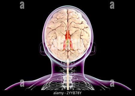 Computerdarstellung eines menschlichen Gehirns mit hervorgehobenem Precuneus Gyrus. Der Precuneus gyrus spielt eine Rolle in der Selbstreflexion, im Gedächtnis und im räumlichen Bewusstsein und ist an verschiedenen neuropsychiatrischen Zuständen beteiligt. Stockfoto