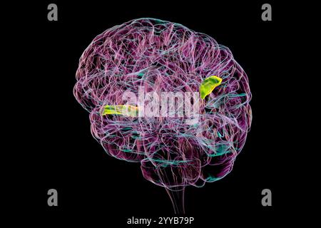 Computerdarstellung eines menschlichen Gehirns mit hervorgehobener transversaler temporaler Gyri, anterior grün und posterior orange. Diese Regionen sind an der auditiven Verarbeitung und dem Sprachverständnis beteiligt. Stockfoto