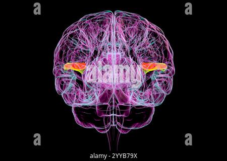 Computerdarstellung eines menschlichen Gehirns mit hinterlegten transversalen Gyri temporalis, anterior grün und posterior orange, Rückansicht. Diese Regionen sind an der auditiven Verarbeitung und dem Sprachverständnis beteiligt. Stockfoto