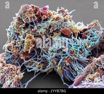 Plakette - Bakterien, Farbig Scanning Electron Micrograph (SEM). Plaque besteht aus einem Film von Bakterien in einem glykoprotein Matrix eingebettet. Die Matrix ist eine bakterielle Sekrete und Speichel gebildet. Zahnbelag ist die Hauptursache für Karies. Die Bakterien ernähren sich von Zucker in der Nahrung, die Säure als Abfallprodukt. Diese Säure greift die Zähne emailbeschichtung, was zu Karies. Die Ansammlung von Zahnbelag kann auch entzündete und infizierten Zahnfleisch führen. Schwere Zahnfleischerkrankungen können Zähne herausfallen führen. Vergrößerung: x2000 bei 10 Zentimeter gedruckt Stockfoto