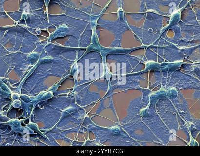 Neuronen. Farbige Rasterelektronenmikroskopie (REM) menschlicher Nervenzellen (Neuronen), die aus einer embryonalen pluripotenten Stammzelle (es) gewonnen wurden. Pluripotente Stammzellen sind in der Lage, sich in jeden der 200 Zelltypen im menschlichen Körper zu differenzieren. Die Art der Zelle, zu der sie Reifen, hängt von den biochemischen Signalen ab, die die unreifen Zellen empfangen. Diese Fähigkeit macht sie zu einer potenziellen Quelle von Zellen, um beschädigtes Gewebe bei Krankheiten wie Parkinson und insulinabhängigem Diabetes zu reparieren. Vergrößerung: x500, wenn 10 Zentimeter breit gedruckt. Stockfoto