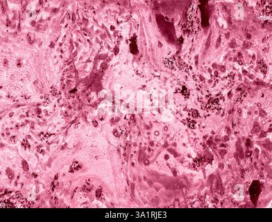 Abstrakter Marmorhintergrund in verschiedenen Rosa-Tönen. Verschiedene Schattierungen von schmutzigem Rosa, lila Punkten. Dunkle und helle Rosa-Töne. Chaotische Flecken und Stockfoto