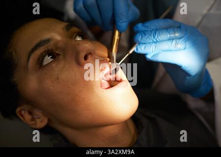 Nahaufnahme einer zahnärztlichen Untersuchung mit den Händen des Zahnarztes in Handschuhen und Werkzeugen, die an einem Patienten arbeiten Stockfoto