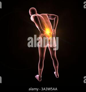 Abbildung einer Person mit Schmerzen im unteren Rücken, die den Lendenbereich betont und Wirbelsäulenbeschwerden, Haltung und Muskelanstrengung darstellt. Stockfoto
