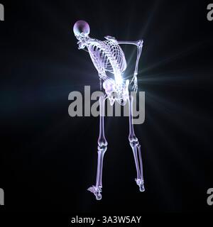 Illustration eines menschlichen Skeletts mit Schmerzen im unteren Rücken, Darstellung von spinalen Beschwerden im Lendenbereich. Stockfoto