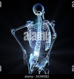 Illustration eines menschlichen Skeletts mit Schmerzen im unteren Rücken, Darstellung von spinalen Beschwerden im Lendenbereich. Stockfoto