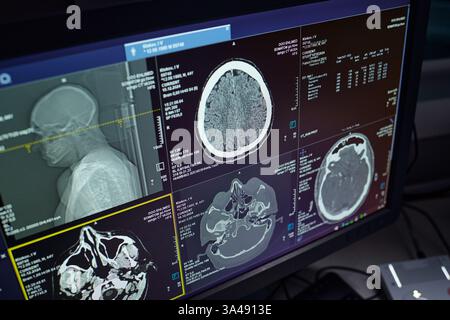 Bilder zeigen verschiedene Gehirnscans auf dem Computerbildschirm in modernen Radiologielabors an und zeigen detaillierte medizinische Bildgebung der Hirnanatomie für diagnostische Zwecke Stockfoto