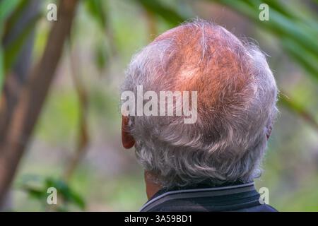 Glatzkopf und weißes Haar für Erwachsene in asien Stockfoto