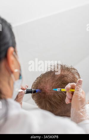 Alopezie. Mann Haarausfall verbessern Wachstumsbehandlung Regeneration, Dermapen Mikroneedling Vitamin Exosomen Spritzen Injektionen. Trichologe Kosmetologe Arzt KopfKopfKopfhautverfahren fraktionelle Mesotherapie Stockfoto