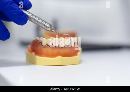 Nahaufnahme eines dentalen Trainingsmodells, das für Parodontalerkrankungen verwendet wird, mit Zahnfleischentzündung, Naht und Plaque-Simulation. Stockfoto