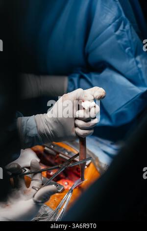 Chirurgisches Team, das einen Patienten im Krankenhaus betreibt. Gesundheitswesen und medizinisches Konzept. Ärzte führen Herzoperationen durch. Vertikale Aufnahme Stockfoto
