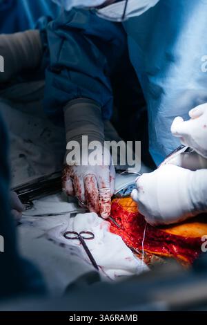 Chirurgisches Team, das einen Patienten im Krankenhaus betreibt. Gesundheitswesen und medizinisches Konzept. Ärzte führen Herzoperationen durch. Vertikale Aufnahme Stockfoto