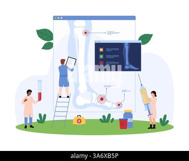 Diagnostik und Behandlung von Gelenkerkrankungen durch Orthopäden. Winzige Leute studieren Röntgenaufnahmen von Patienten Bein mit Entzündung und Schmerzen in Knie und Fuß, um Arthritis Cartoon Vektor Illustration zu diagnostizieren Stock Vektor
